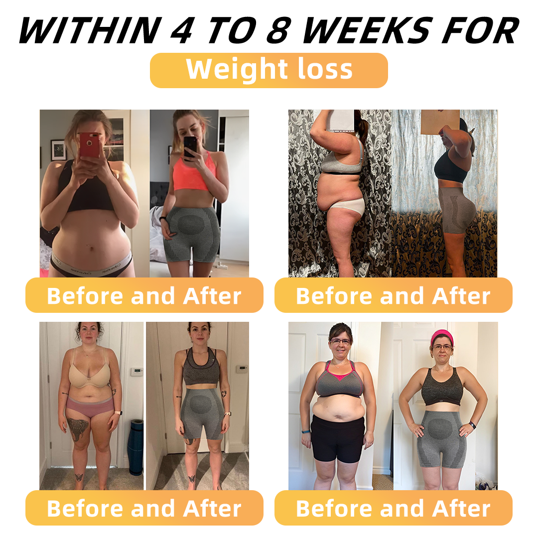 ใOfficial Brand Storeใ๐ฅ๐๐๐๐๐๐๐๐๐ยฎ Ion Shaping Shorts, Breathable Comfort Fabric With Tourmaline. Restore Your Perfect Figure And Address Health Issues๐ฅ
